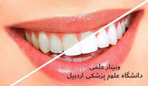 وبینار علمی دندانپزشکی ترمیمی