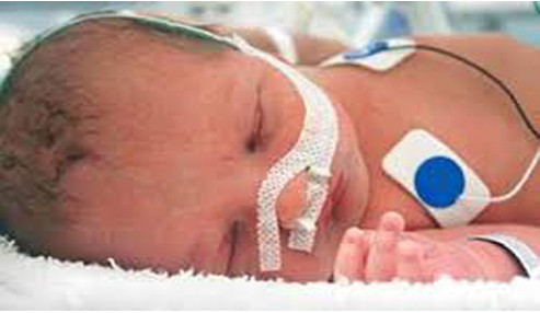 وبینار علمی ارزیابی بالینی و کمک تشخیصی نوزاد مبتلا به دیسترس تنفسی