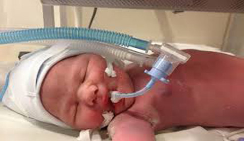 وبینار علمی مراقبت تنفسی نوزادان با اکسیژن