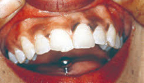 وبینار علمی  برخورد با ضایعات دهانی متعاقب درمان های انکولوژی