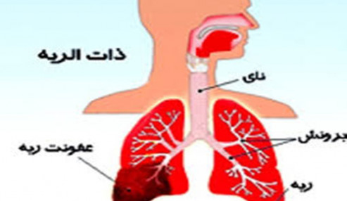 وبینار علمی بررسی اصول تشخیص و درمان عفونت¬های حاد تنفسی