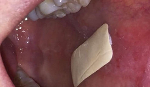 وبینار علمی  بیماریهای دهان