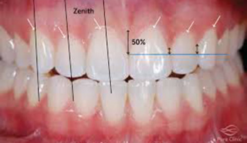 وبینار علمی  درمان های جراحی برای بازسازی دندانی و زیبایی