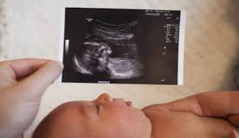 وبینار علمی  ارزیابی ناهنجاری های جنین