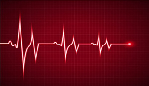 بیماریهای عروق کرونر و تغییرات نوار قلبی