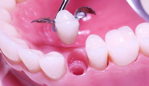 وبینار علمی  پروتزهای دندانی