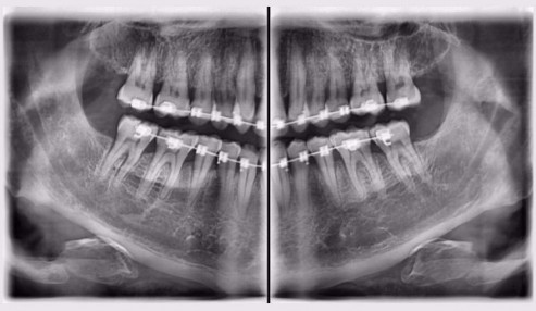 وبینار علمی  رادیولوژی دهان و دندان 1