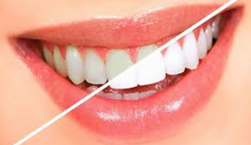 وبینار علمی  ملاحظات زیبایی در درمان های دندانپزشکی چند رشته ای
