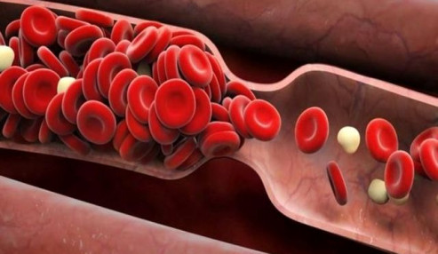 وبینار علمی  هموویژیلانس و مدیریت مصرف خون و فراورده های خونی