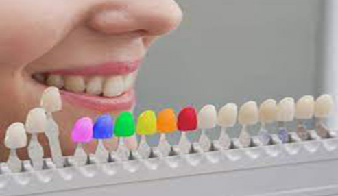 وبینار علمی انتخاب رنگ در دندانپزشکی